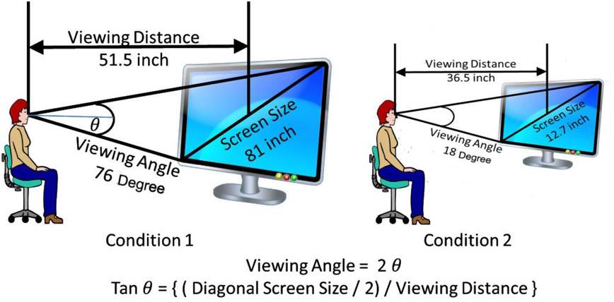 Screen Size vs Viewing Distance: The Gaming Setup Mistake Killing Your Reaction Time